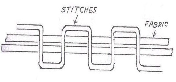 types of stitches-209