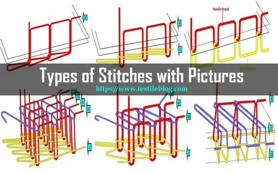 types of stitches