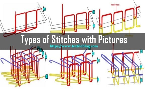 types of stitches